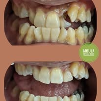 Dental Treatment